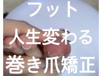 ベルオングル(Bellongle)の写真