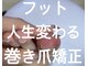 ベルオングル(Bellongle)の写真