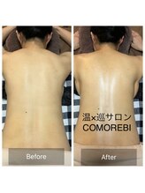 コモレビ(COMOREBI)/バザルトボディ背中☆1回の施術