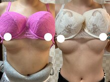 ハレオラ(HaleOla)/20代☆1年２ヶ月の育乳成果♪