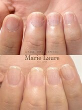 マリーロール 梅田店(Marie Laure)/深爪改善/自爪育成/ネイルケア