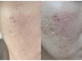 バリーズ(Valley's)/