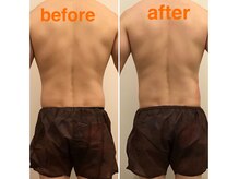 クレール グラン エステ/脂肪冷却【メンズ】脱げる身体へ