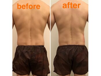 クレール グラン エステ/脂肪冷却【メンズ】脱げる身体へ