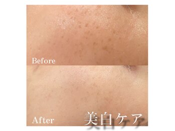 フォルチェ ゆめタウン広島店(Folche)