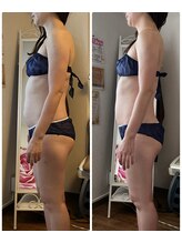 ビューティアップ 茶屋町店(Beauty Up)/【光痩身コース】1回での変化！