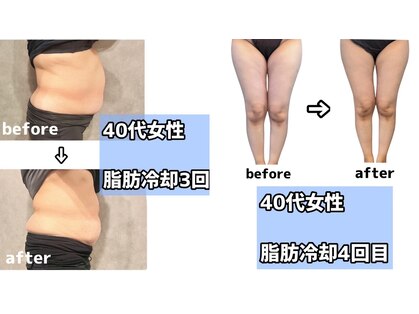 rvコーディネイトサロン(rv coordinate salon)の写真