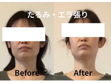 エミフル 若松原店(EMIFULL)の雰囲気（根本からのアプローチで結果出しに自信あり）