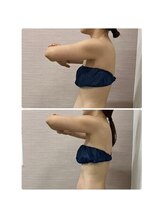 ソフィア わさだ店/30代女性セルゼロ全身コース