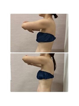 ソフィア わさだ店/30代女性セルゼロ全身コース