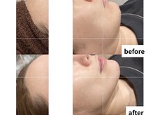 【痩身/小顔/毛穴/フェイシャルサロン】Dahlia Beauty【ダリアビューティー】春日井の雰囲気(30分で驚きの効果!小顔キャビ¥5500 フェイスラインのもたつき◎)