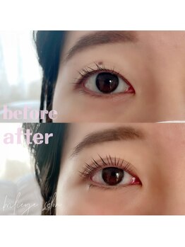 ブリリーアイ サロン(brilieye salon)/奥二重→二重に!