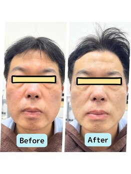 リオンズ 千葉アリオ柏店/男性にもおすすめ