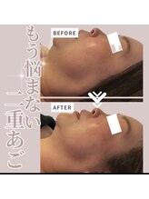 ソワン(Soin)/40代　小顔引き上げフェイシャル