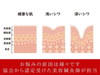 ケンビ(Kenbi)/美容鍼/整体マッサージ/小顔毛穴