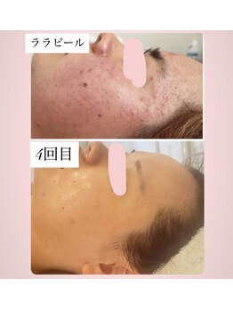 メゾン アンジュ(Maison Ange)/ララピール