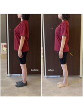 ニコディア(nico-dia)/全身矯正