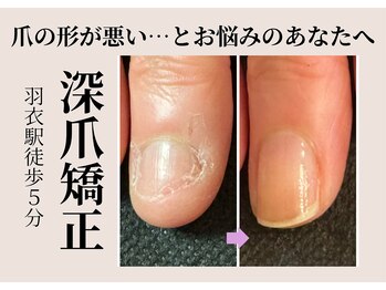 ネイルサロン ベルエトワール(belle etoile)