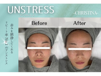 リトルヒロシマ(little hiroshima)の写真