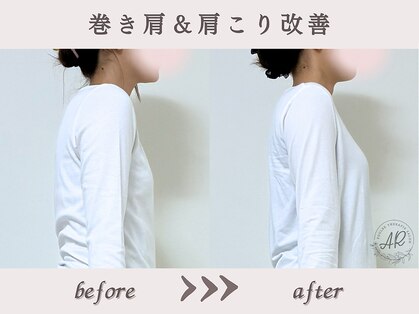 エーアール(AR)の写真