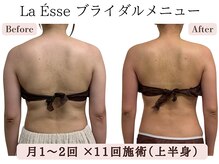 ラエッセ(La Esse)/*ブライダル*ドレス映えする背中