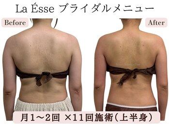 ラエッセ(La Esse)/*ブライダル*ドレス映えする背中