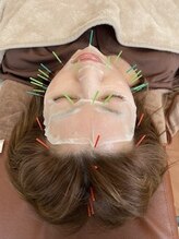 アキュリス(aquliss)