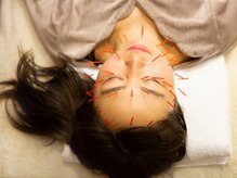 もり鍼灸整骨院 今出川マッサージ治療院/美容鍼/小顔矯正