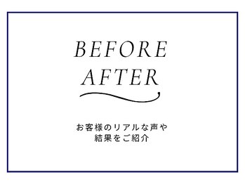 ニキビケア研究所 所沢店/BEFORE AFTER