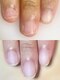 シェイプネイル(Shape Nail)の写真/【ケア×ジェル】自爪に優しいネイルサロン☆駅チカで通いやすい!花園駅から徒歩５分◎