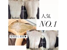 スキンハピネス(skinhappiness)の雰囲気（結果出し重視★背中トラブル撃退ケア色々なお肌悩みも解決）