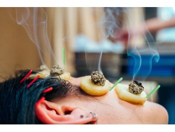 中村温灸院/お顔のお灸