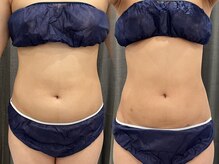 アエ メゾン(ae maison)/綺麗なウエストラインに♪