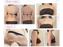 痩せる専門店　ラ・フルール［痩身/ブライダル/バストアップ/小顔フェイシャル］の雰囲気（実績多数!痩せたい!キレイになりたい!姿勢整えたい!叶えます♪）