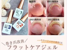 ネイルドットイチマルハチ(Nail.108)の雰囲気（足裏の角質除去・巻爪改善などのお爪やお足元の悩みを解消します）