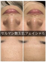 ソラウミ(SORAUMI)/角質ケアしてますか？