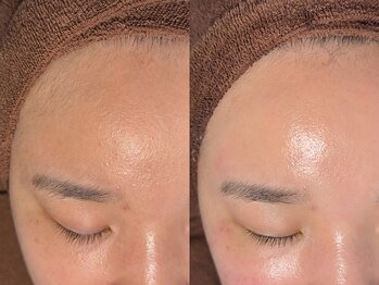 ルーナジェーナ(Luna llena)/池袋 エステ ルーナジェーナ