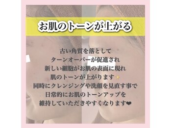 ホワイトアクア 天王寺本店(WHITE AQUA)/ハーブピーリング/大阪/天王寺