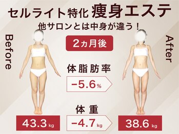 ラ パルレ 横浜本店/全身セルライトケア