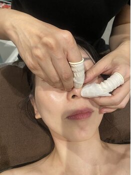 Peach Pure ピーチ ピュアの写真/【毛穴エクストラクション】機械や吸引では落とせない毛穴の汚れを取り除く!角栓・皮脂汚れニキビ予防に◎