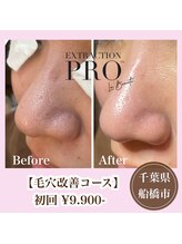 フラリス(fraris)/ぷるぷる生パック