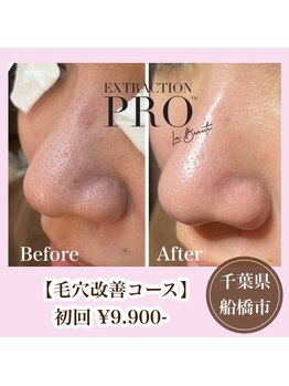 フラリス(fraris)/ぷるぷる生パック