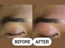 ソーレエルーナ(SOLE e LUNA)/メンズ 新宿 眉毛 ワックス脱毛