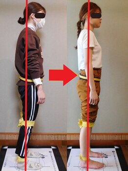 チャラク(charaku)/【30代F様：猫背矯正】