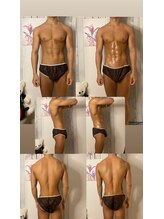 京橋メンズビューティーラボ(KMB LAB.)/ハイパーナイフのbefore/after