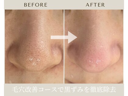 リベルテ 岡山(liberte)の写真
