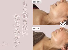エニ(Eni)/肌のハリ・弾力アップ