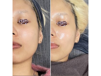 スリーアイ 天王寺店(3EYE)の写真