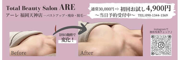 アーレ 福岡天神店(ARE)のサロンヘッダー