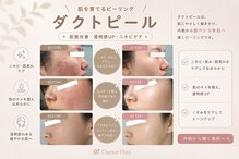 シュシュ(chouchou)